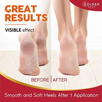 24K Gold Foot Peel Mask - Argan Oil, Aloe Vera, Vitamin A & E Exfoliating Masks - Baby Soft Peeling Socks - for Dead Skin & Dry Feet - Cracked Heels & Rough Calluses Remover - Smooth Foot Repair