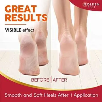 24K Gold Foot Peel Mask - Argan Oil, Aloe Vera, Vitamin A & E Exfoliating Masks - Baby Soft Peeling Socks - for Dead Skin & Dry Feet - Cracked Heels & Rough Calluses Remover - Smooth Foot Repair