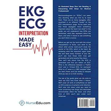 ECG Interpretation Guide for Students - Easy to Learn