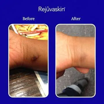 Rejuvaskin Scar Fx Silicone Tape for Surgical Scars