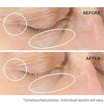 StriVectin Anti-Wrinkle Intensive Eye Cream Concentrate for Wrinkles PLUS, Targets Crow's Feet, Firmness, Puffiness and Dark Circles, 1 Fl oz