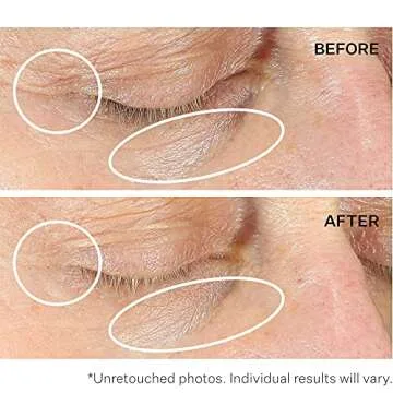 StriVectin Anti-Wrinkle Intensive Eye Cream Concentrate for Wrinkles PLUS, Targets Crow's Feet, Firmness, Puffiness and Dark Circles, 1 Fl oz