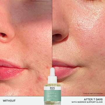 REN Clean Skincare - Evercalm™ Barrier Support Elixir - Skin Barrier Strengthening Face Oil for Dry & Sensitive Skin, 1 fl oz