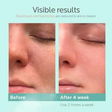 Colorfarm Facial Steamer - Deep Cleansing Nano Ionic Spa