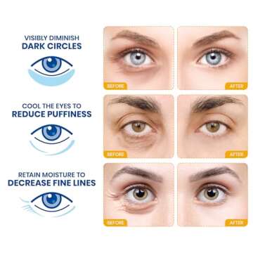 Stylia Under Eye Patches for Dark Circles and Puffy Eyes (20 Pairs) - 24k Gold Collagen Mask with Hy...