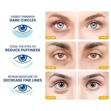 Stylia Under Eye Patches for Dark Circles and Puffy Eyes (20 Pairs) - 24k Gold Collagen Mask with Hy...