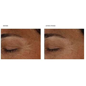 Dr. Dennis Gross B³Adaptive SuperFoods™ Rescue Super Serum. For Worry Lines, Flareups, and Dullness, 1.0 fl oz