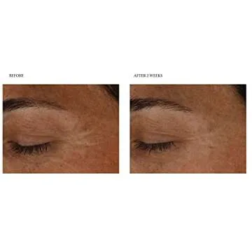 Dr. Dennis Gross B³Adaptive SuperFoods™ Rescue Super Serum. For Worry Lines, Flareups, and Dullness, 1.0 fl oz