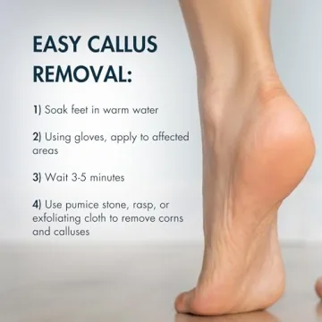 DeEnti Extra Strength Callus Remover Gel for Smooth Feet
