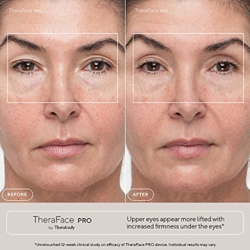 TheraFace PRO Microcurrent Facial Device for Skin Care