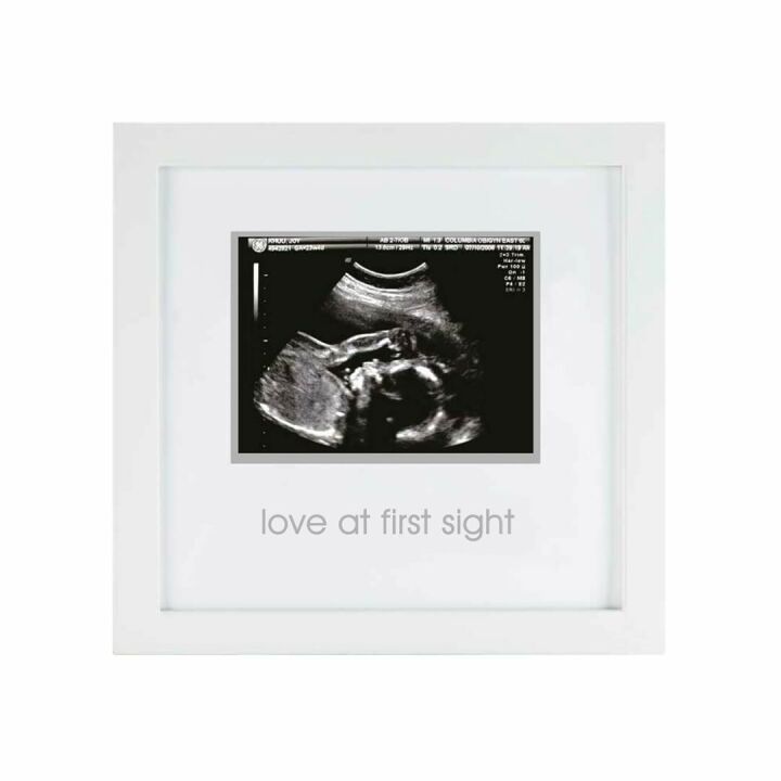 Sonogram Picture Frame - Gender Neutral Ultrasound Keepsake