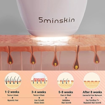 5 Min Skin Hair Laser Removal - Quick, Painless Solution