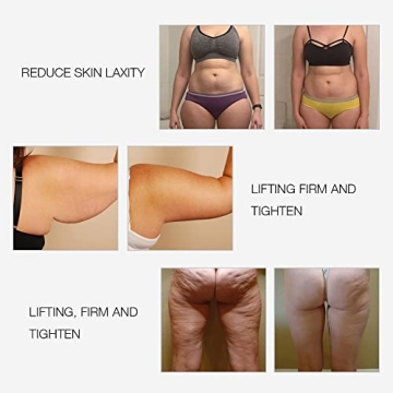 MLAY Radio Frequency Skin Tightening Device for Youthful Skin