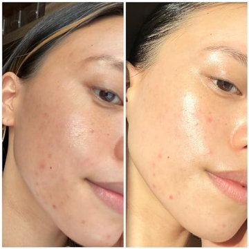 Hydrating Mask with Hyaluronic Acid for Sensitive Skin