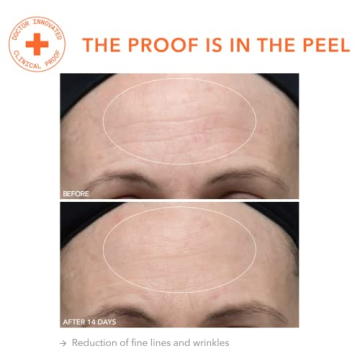 Dr. Dennis Gross Daily Peel for Sensitive Skin | 30 Treatments