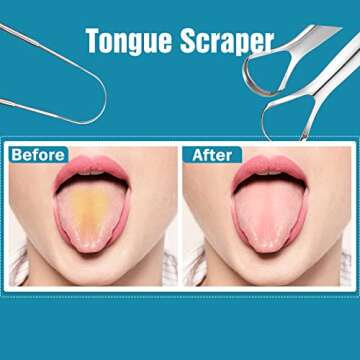 3 PCS Metal Tongue Scraper, Tongue Scrapers for Adults, Stainless Steel Tounge Scrappers, Tounge Scraper, Portable Tongue Scrappers YLYL