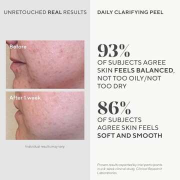 Murad Daily Clarifying Peel – Exfoliating Peel Solution – Resurfacing Retinoid/AHA/BHA Liquid - Skin-Smoothing Retinoid, Salicylic Acid & Glycolic Acid Peel for Face, 3.2 Fl Oz