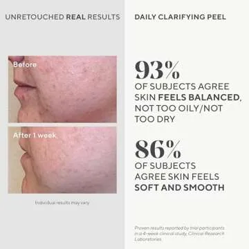 Murad Daily Clarifying Peel – Exfoliating Peel Solution – Resurfacing Retinoid/AHA/BHA Liquid - Skin-Smoothing Retinoid, Salicylic Acid & Glycolic Acid Peel for Face, 3.2 Fl Oz