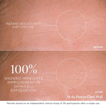 M-61 PowerGlow® Peel for Radiant Skin in 1 Minute