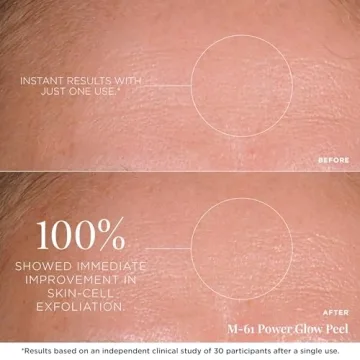M-61 PowerGlow® Peel for Radiant Skin in 1 Minute