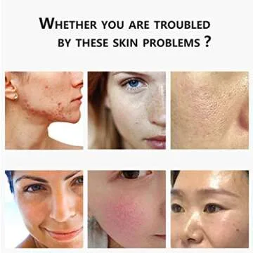 Foldable Skin Care Machine - LED Therapy & Rejuvenation