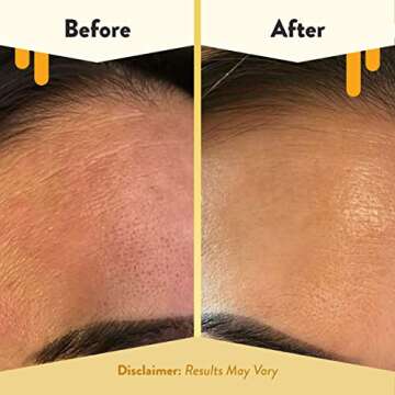 ECZEMA HONEY 15% Vitamin C + Ferulic Acid Serum - Anti Aging Skin Care Products - Face Oil for Eczema, Dry & Sensitive Skin (1 Oz)