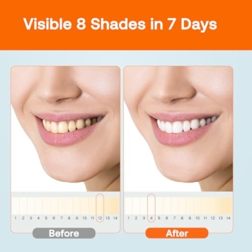 Bitvae LED Teeth Whitening Kit Safe Fast Sensitive Teeth