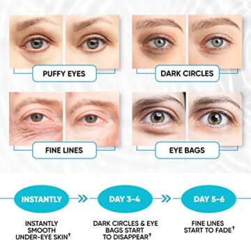 Under Eye Patches for Puffy Eyes, Dark Circles, Dull Skin - Natural Moisturizing Support - Help with Wrinkles and Fine Lines - Under Eye Mask with Hyaluronic Acid, Collagen, Caffeine - 30 Pairs