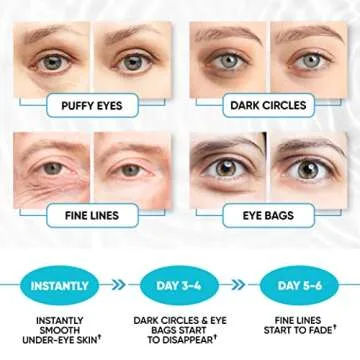 Under Eye Patches for Puffy Eyes, Dark Circles, Dull Skin - Natural Moisturizing Support - Help with Wrinkles and Fine Lines - Under Eye Mask with Hyaluronic Acid, Collagen, Caffeine - 30 Pairs