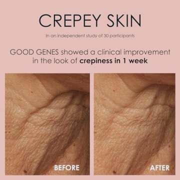 Sunday Riley Sunday GGL-15-US-FG Riley Good Genes All-In-One Lactic Acid Treatment Face Serum 0.5oz