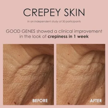 Sunday Riley Sunday GGL-15-US-FG Riley Good Genes All-In-One Lactic Acid Treatment Face Serum 0.5oz