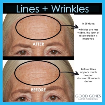 Sunday Riley Sunday GGL-15-US-FG Riley Good Genes All-In-One Lactic Acid Treatment Face Serum 0.5oz