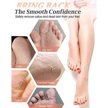 Maryton Natural Pumice Stone for Feet - Lava Foot Exfoliator Scrubber Pedicure Tools, Dead Skin Corn Callus Remover for Feet and Hands, 1 Count