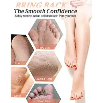 Maryton Natural Pumice Stone for Feet - Lava Foot Exfoliator Scrubber Pedicure Tools, Dead Skin Corn Callus Remover for Feet and Hands, 1 Count