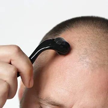 ROSELYNBOUTIQUE Derma Roller 540 Titanium Microneedle Hair Skin