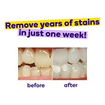 BURST Teeth Whitening Strips with Soothing Coconut Oil for Sensitivity, Gentle on Gums, Deep Stain Removal, Enamel Safe, No Chemical Taste, Works in 15 Minutes, Fast Results, 7 Treatments