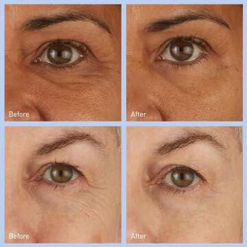 Skyn Iceland Hydro Cool Firming Eye Patches for Wrinkles & Puffiness