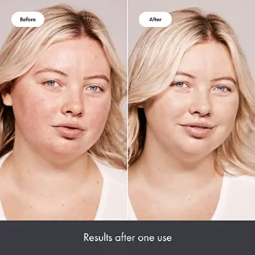 Hero Cosmetics Rescue Balm Red Correct Recovery Cream