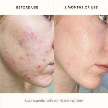 Hydrating Foaming Lemon Facial Cleanser - Vegan & Gentle