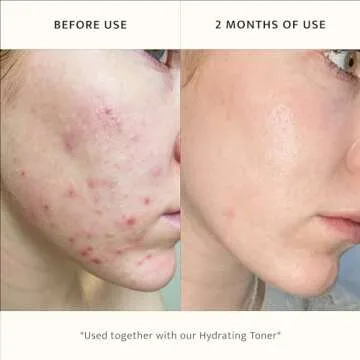 Hydrating Foaming Lemon Facial Cleanser - Vegan & Gentle