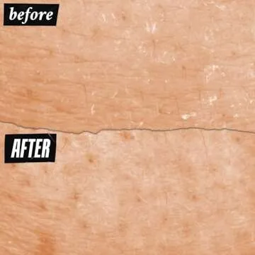 Kiehl's Ultra Facial Skin Barrier Repair Balm, On-the-go Stick Formula, All-day Hydration, Soft and Supple Skin, with Squalane and Ceramides, Wear Under or Over Makeup, for All Skin Types - 0.3 oz