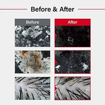 Revitalize Your Scalp with Dr.FORHAIR Folligen Sea Salt Scaler