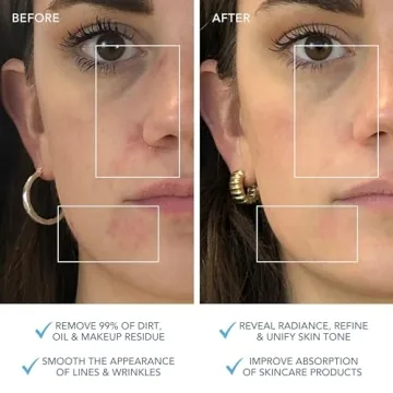 FOREO LUNA 3 Cleansing Brush | Spa Treatment at Home