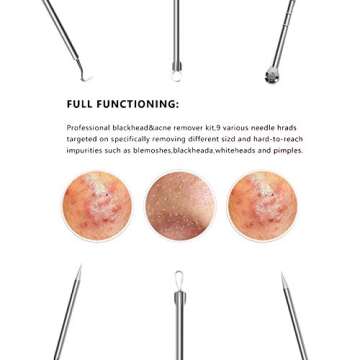 9PCS Blackhead Remover,Acne Removal Tool,Comedone Extractor Tool,Best Blackhead Remover,Treatment Blemish,Whitehead Remover Tool,Risk Free Nose Facial Skin Removal Kit