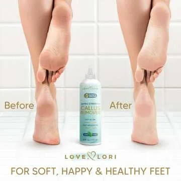 Callus Remover Gel - Extra Strength for Feet Scrubbing