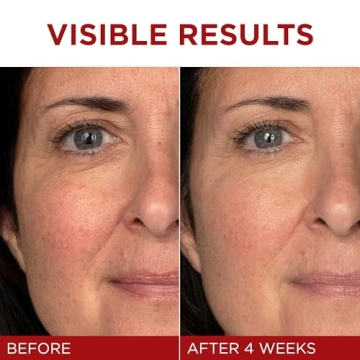 L'Oreal Revitalift Anti-Aging Moisturizer with Pro Retinol and Vitamin C