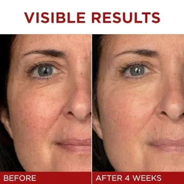 L'Oreal Revitalift Anti-Aging Moisturizer with Pro Retinol and Vitamin C