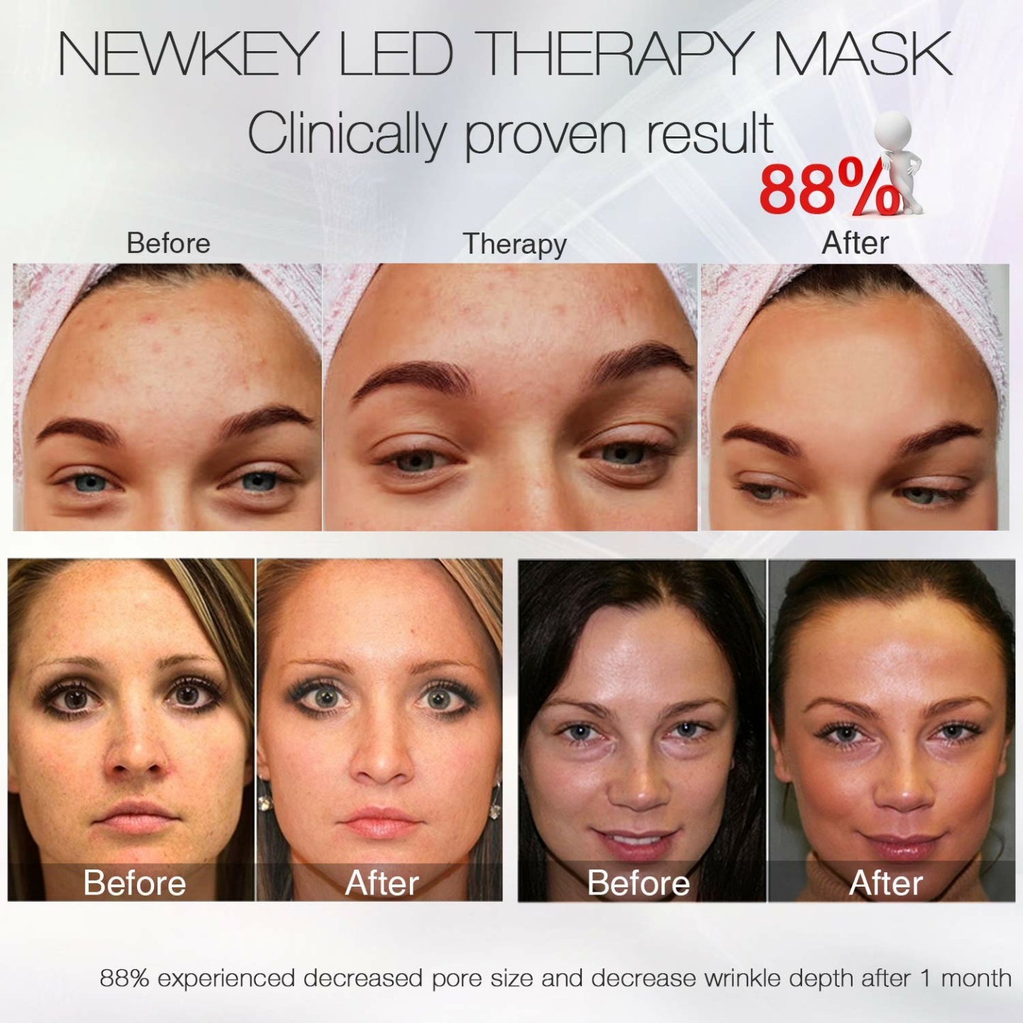NEWKEY LED Light Therapy Mask for Acne Treatment