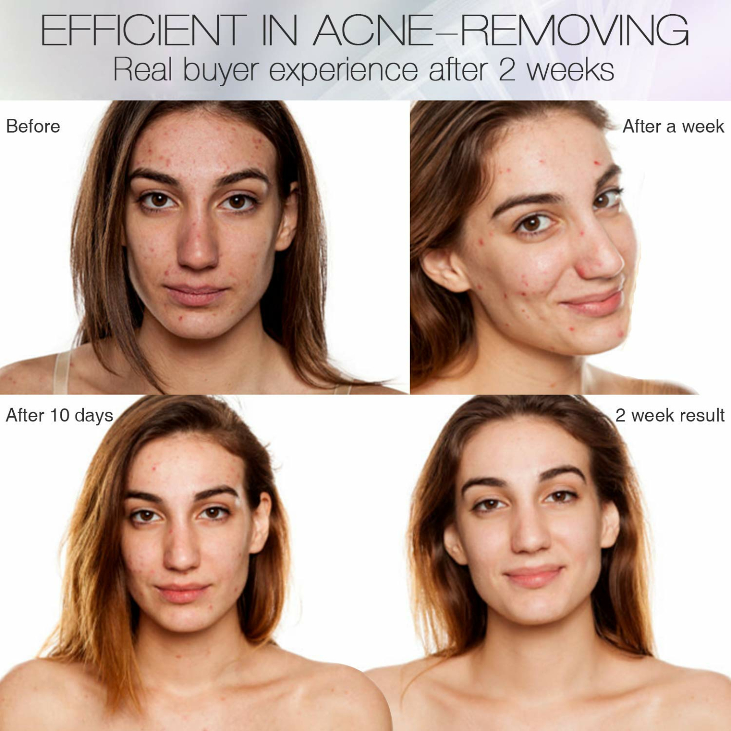 NEWKEY LED Light Therapy Mask for Acne Treatment