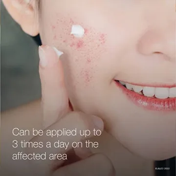 Neutrogena Rapid Clear Acne Treatment Gel 10% Benzoyl Peroxide